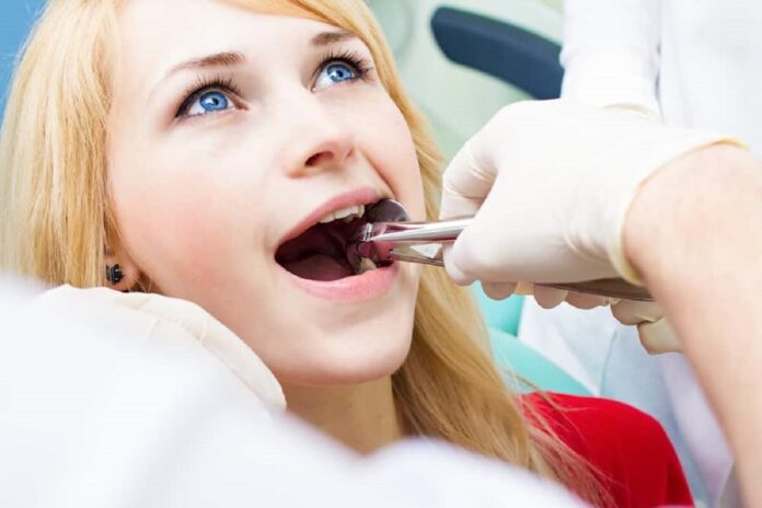 Dentist-Recommended Wisdom Teeth Removal