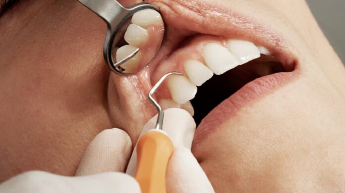 A Comprehensive Guide to Dentists and Dental Implants